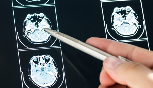 Especialidade: Neuroendocrinologia